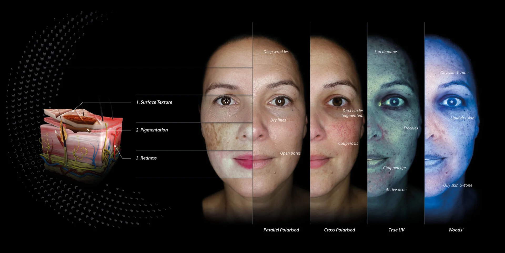 Skin Analysis